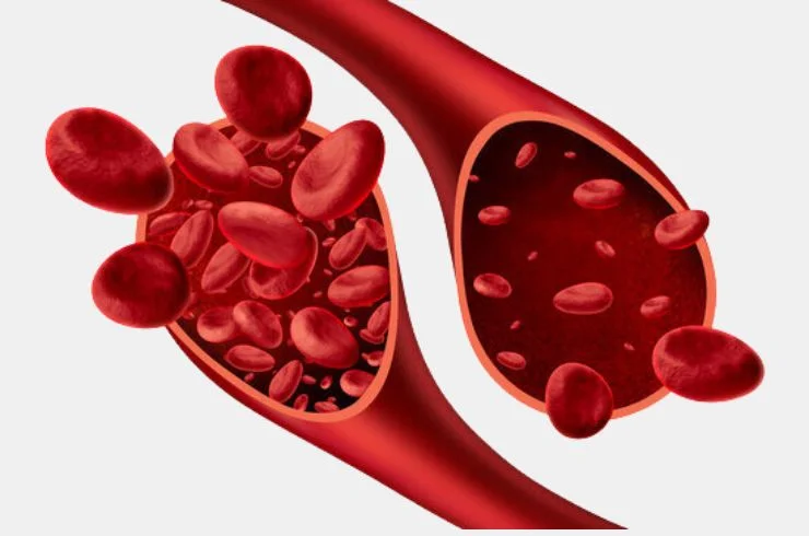 ANAEMIA PROFILE Elite Diagnostics, Dr. Santosh Kondapalli