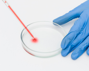 Elite Diagnostics, Dr. Santosh Kondapalli